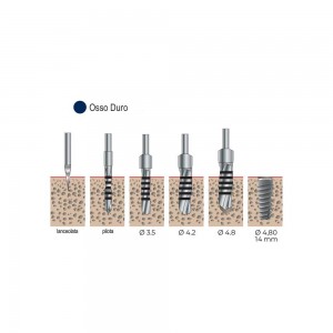 Kit Chirurgico per linea GOLD